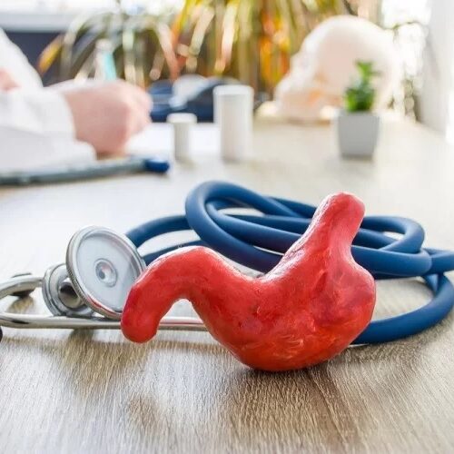 Καρκίνος στομάχου Πρώιμα συμπτώματα που θα σας κινητοποιήσουν