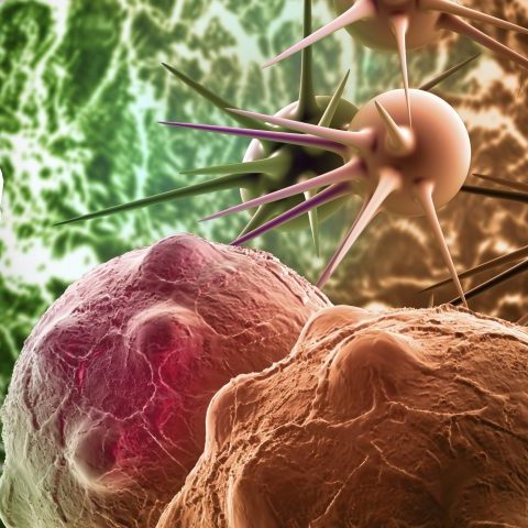 Καρκίνος του πέους