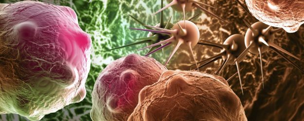 Καρκίνος του πέους