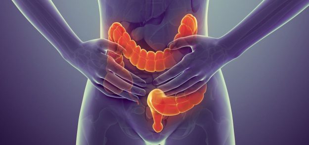 Καρκίνος του παχέος εντέρου