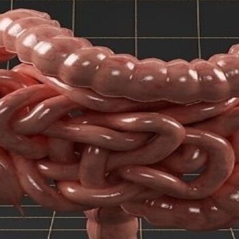 Καρκίνος του παχέος εντέρου