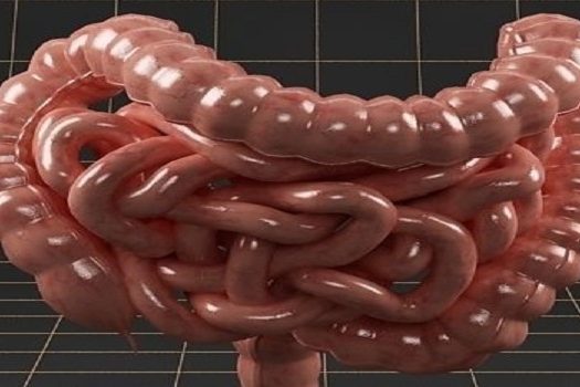 Καρκίνος του παχέος εντέρου Καρκίνος του παχέος εντέρου