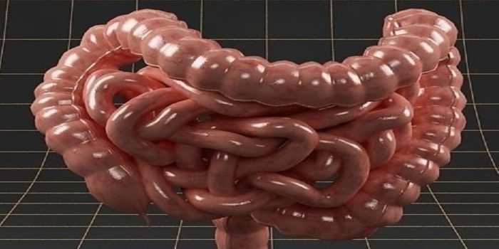 Καρκίνος του παχέος εντέρου Καρκίνος του παχέος εντέρου