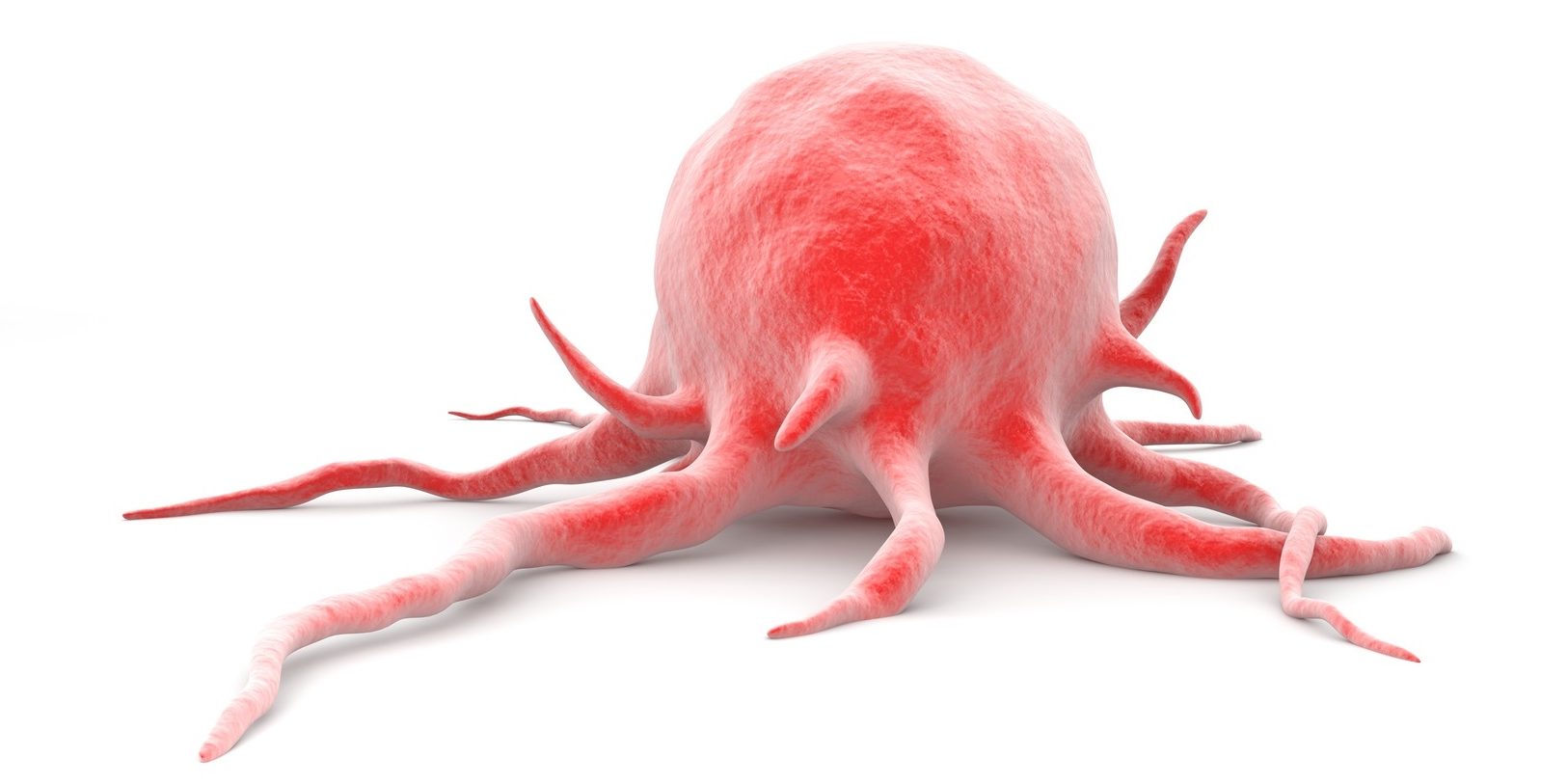 Νέα έρευνα ρίχνει φως στην ανίχνευση του καρκίνου του πρωκτού Νέα έρευνα ρίχνει φως στην ανίχνευση του καρκίνου του πρωκτού