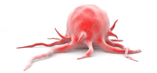 Νέα έρευνα ρίχνει φως στην ανίχνευση του καρκίνου του πρωκτού