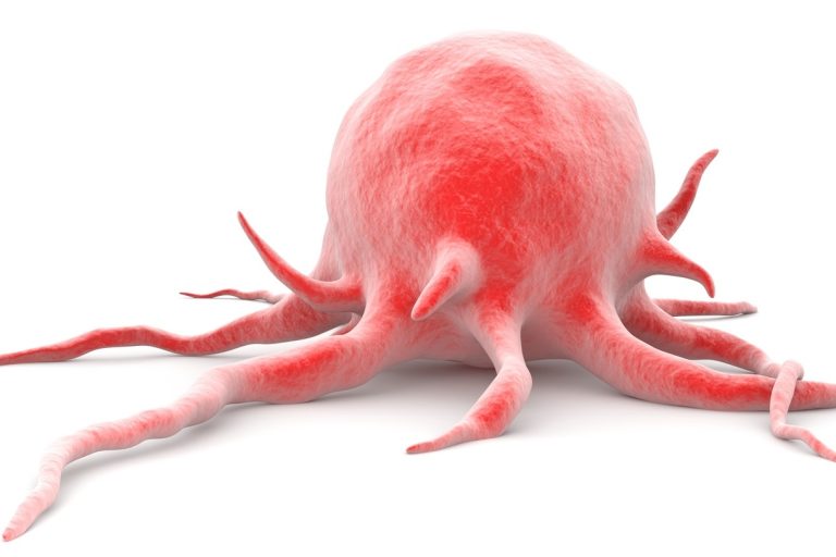 Νέα έρευνα ρίχνει φως στην ανίχνευση του καρκίνου του πρωκτού