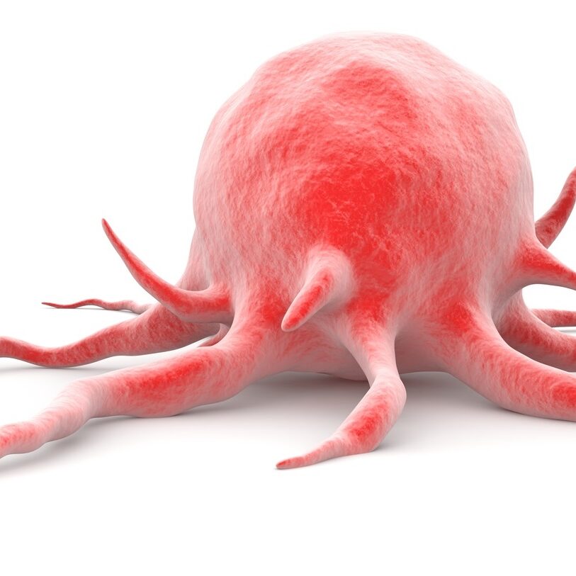 Νέα έρευνα ρίχνει φως στην ανίχνευση του καρκίνου του πρωκτού