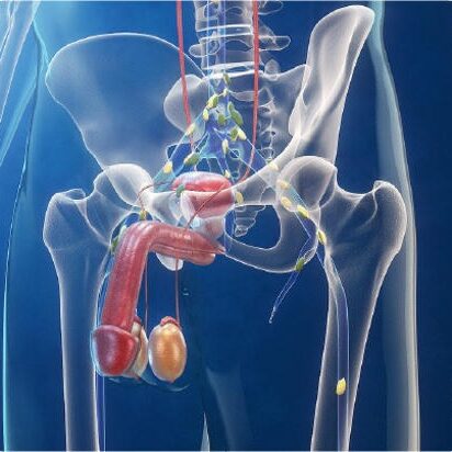 Λίπη και καρκίνος προστάτη