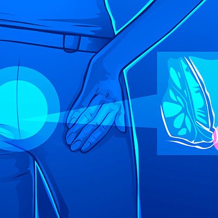 Κλινική εικόνα και διάγνωση των αιμορροΐδων