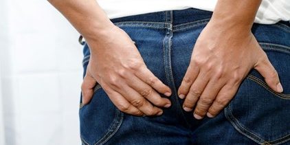 Κονδυλώματα Πρωκτού