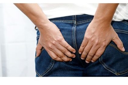 Κονδυλώματα Πρωκτού Κονδυλώματα Πρωκτού