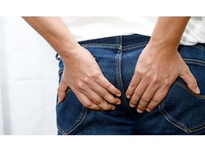 Κονδυλώματα Πρωκτού