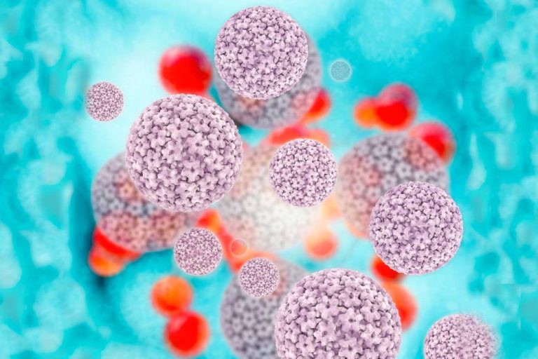 Κονδυλώματα Πρωκτού: Πότε χρειάζεται χειρουργείο;