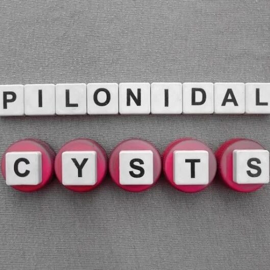 Κύστη Κόκκυγος