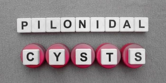 Κύστη Κόκκυγος Κύστη Κόκκυγος