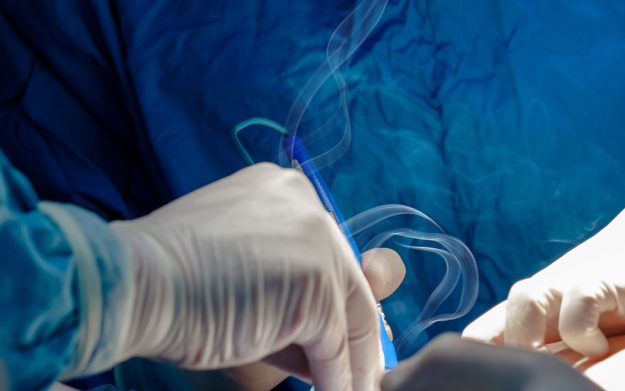 Λέιζερ επεμβάσεις παθήσεων πρωκτού Πότε εφαρμόζονται & ποια είναι τα οφέλη;