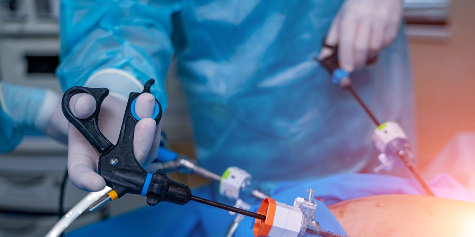 Λαπαροσκοπική Επέμβαση για τη Θεραπεία Κηλών Διαδικασία & Πλεονεκτήματα