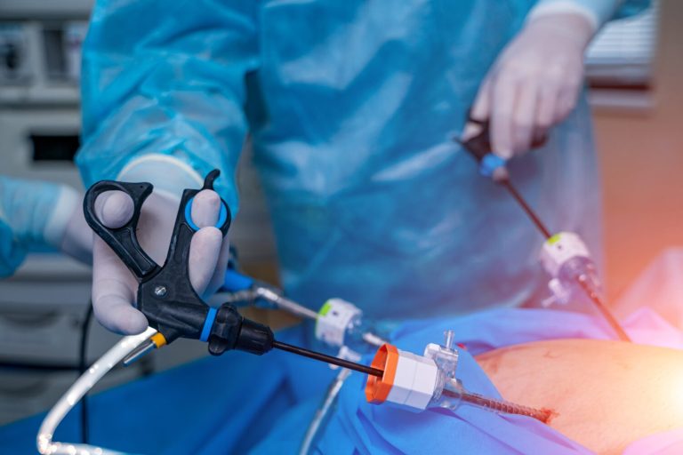 Λαπαροσκοπική Επέμβαση για τη Θεραπεία Κηλών Διαδικασία Πλεονεκτήματα | Iatromedia.gr