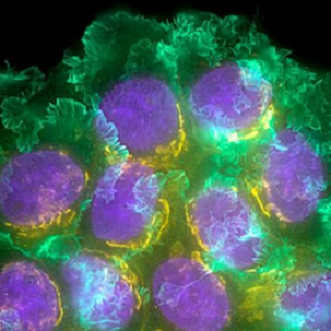 Μοριακή απεικόνιση μαστού