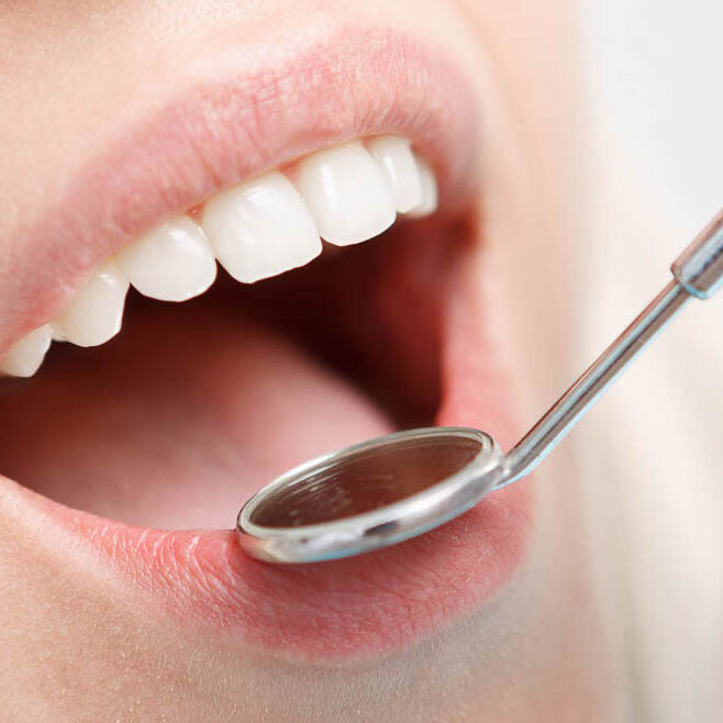 Μπορούν τα έγκλειστα δόντια να προληφθούν;