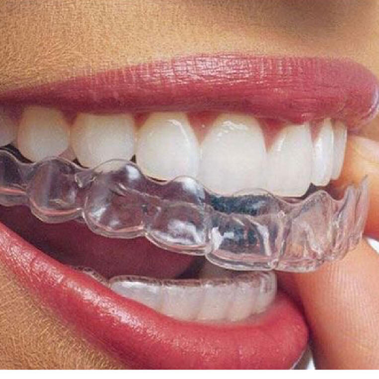 Μπορώ να αποκτήσω ίσια δόντια χωρίς σιδεράκια;