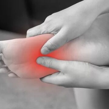 Νεύρωμα Morton