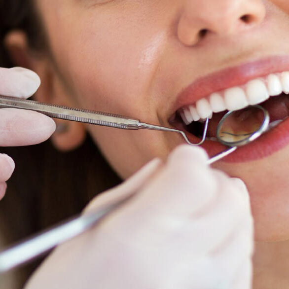 Οδοντιατρικός Έλεγχος: Γιατί πρέπει να πραγματοποιείται τακτικά;