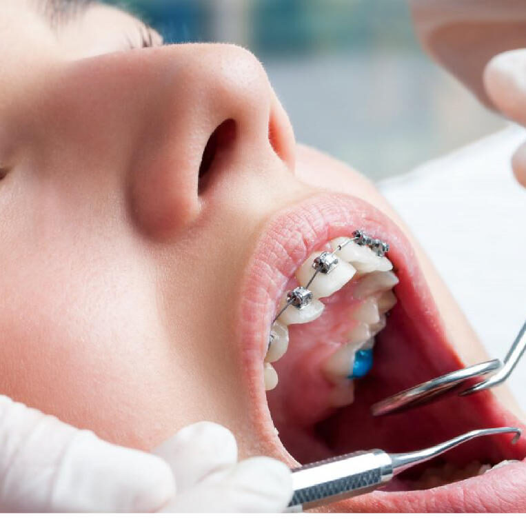 Οι απεικονιστικές εξετάσεις της ορθοδοντικής θεραπείας