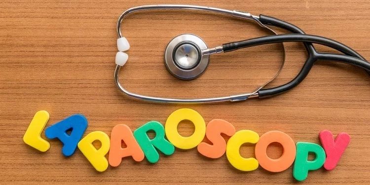 Ομφαλοκήλη Ομφαλοκήλη