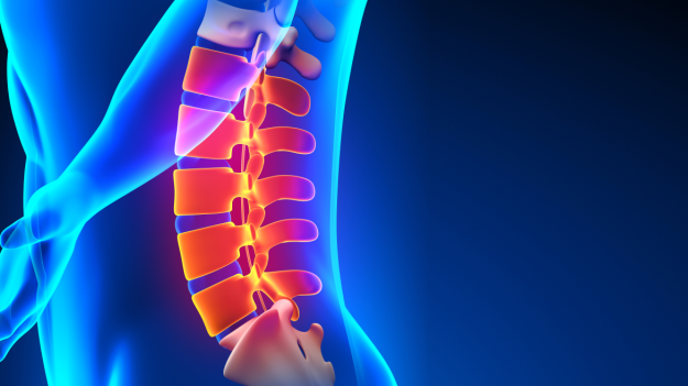 Οσφυϊκή Δισκεκτομή: Διαδικασία & Ανάρρωση