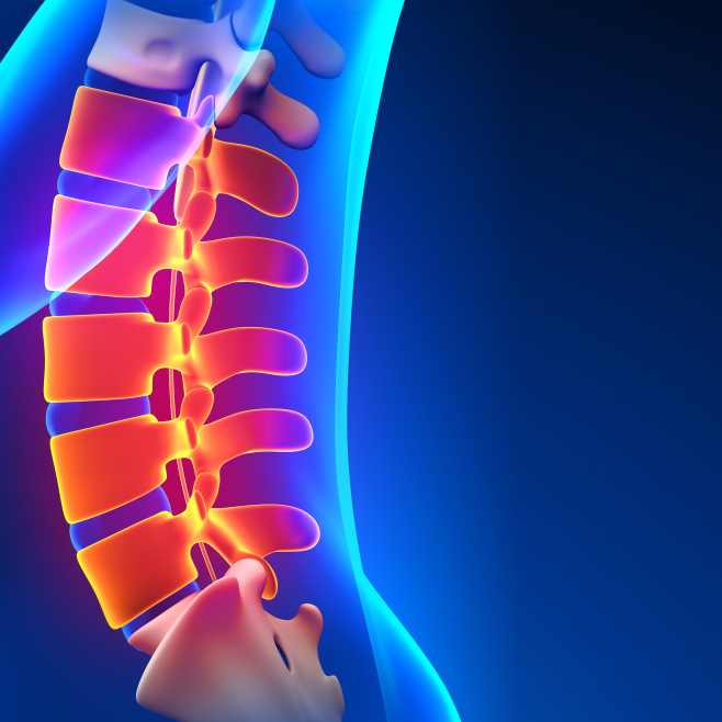 Οσφυϊκή Δισκεκτομή: Διαδικασία & Ανάρρωση