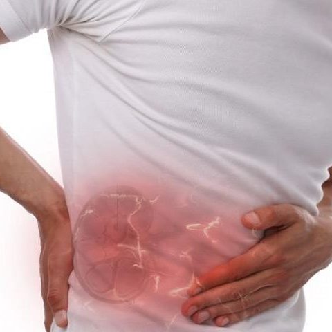 Πέτρες στα νεφρά