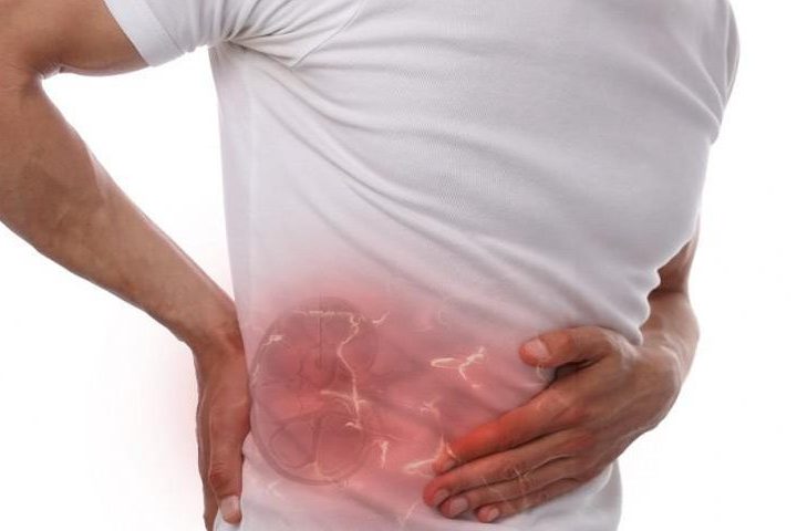 Πέτρες στα νεφρά Πέτρες στα νεφρά