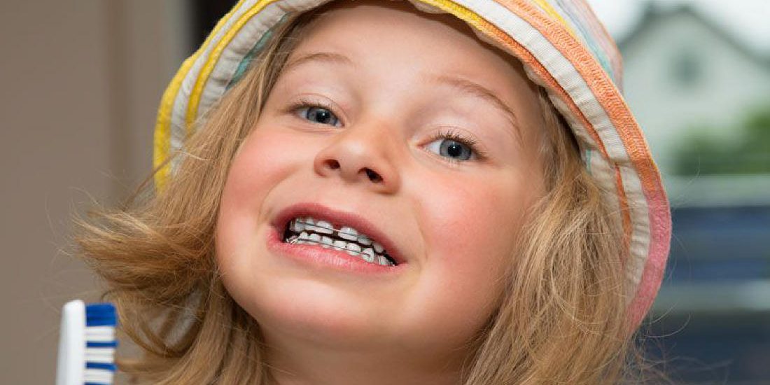 Ποια είναι η κατάλληλη ηλικία για ορθοδοντική θεραπεία;