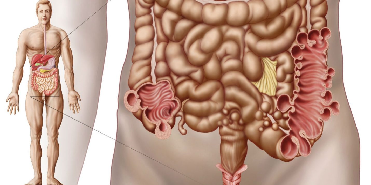 Ποια είναι τα συμπτώματα του καρκίνου του ορθού; Ποια είναι τα συμπτώματα του καρκίνου του ορθού;