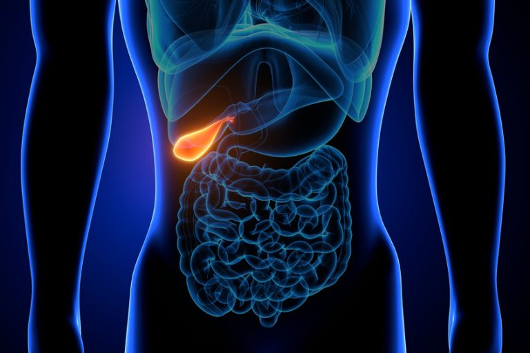 Πολύποδες Χοληδόχου Κύστης