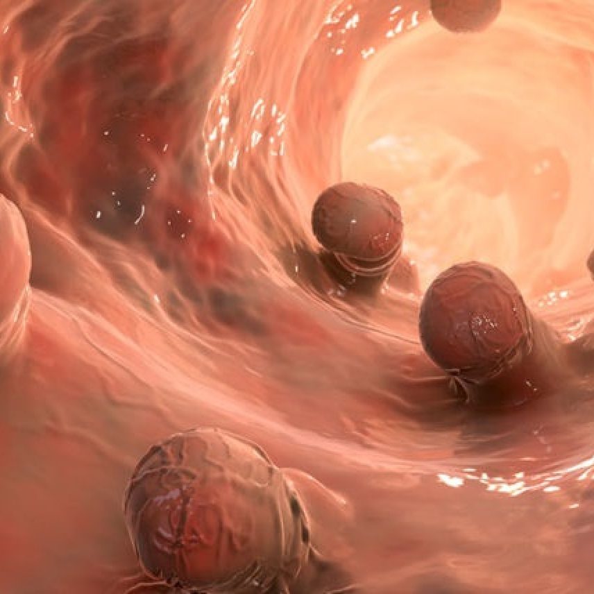 Πολύποδες εντέρου