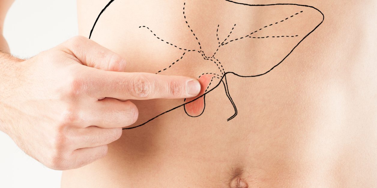 Πολύποδες χοληδόχου κύστης