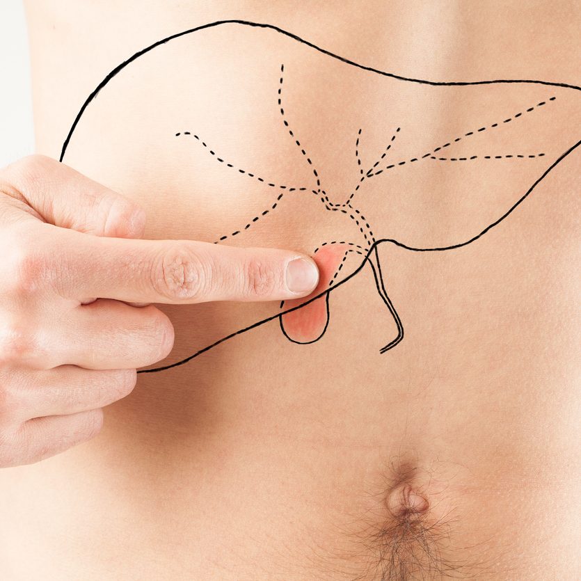 Πολύποδες χοληδόχου κύστης