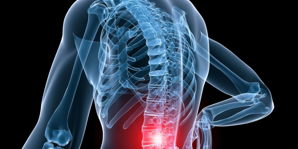 Πόνος στη Μέση και Παθήσεις: Ποιες είναι και πώς αντιμετωπίζονται