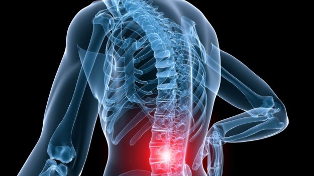 Πόνος στη Μέση και Παθήσεις: Ποιες είναι και πώς αντιμετωπίζονται