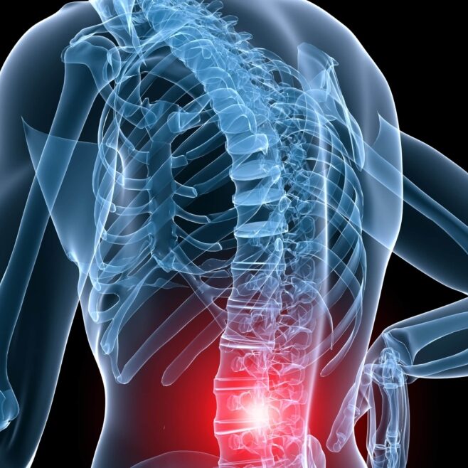 Πόνος στη Μέση και Παθήσεις: Ποιες είναι και πώς αντιμετωπίζονται