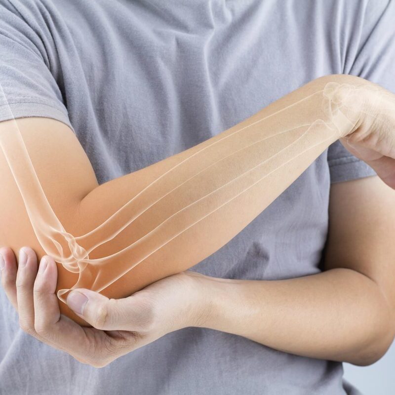 Πόνος στον Αγκώνα