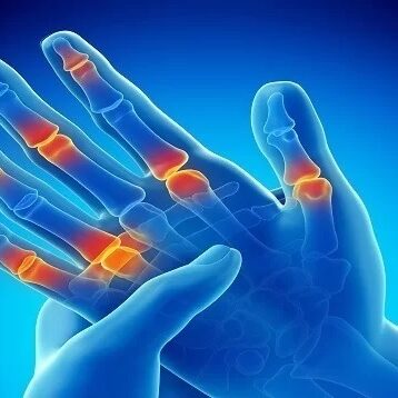Πόνος στον Καρπό και τα Δάκτυλα