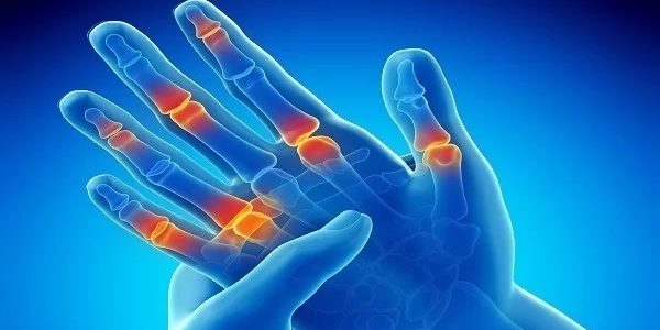 Πόνος στον Καρπό και τα Δάκτυλα