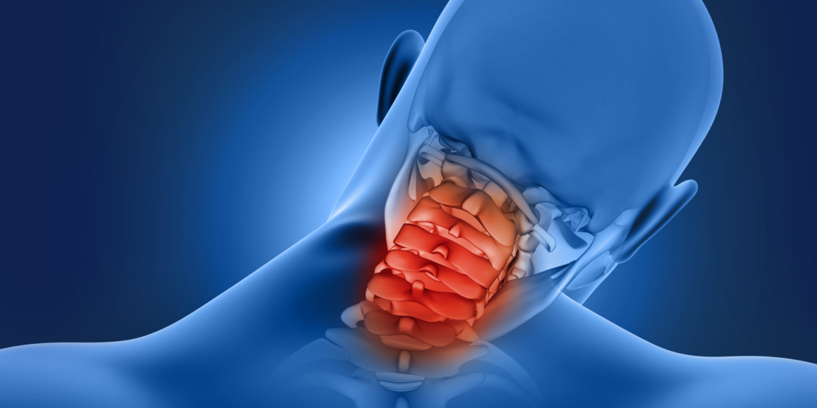 Πόνος στον αυχένα: Τι υποδηλώνει & πώς αντιμετωπίζεται Πόνος στον αυχένα: Τι υποδηλώνει & πώς αντιμετωπίζεται