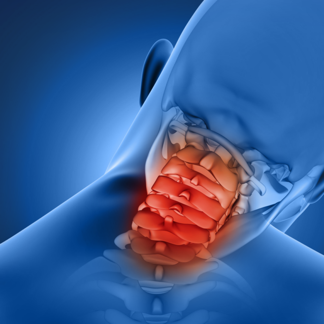 Πόνος στον αυχένα: Τι υποδηλώνει & πώς αντιμετωπίζεται