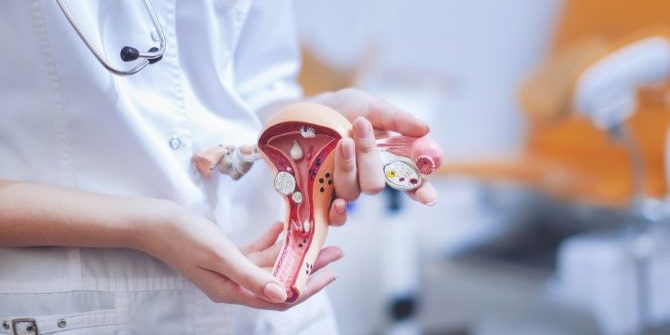 Πότε πρέπει να γίνει αφαίρεση της μήτρας μιας γυναίκας;