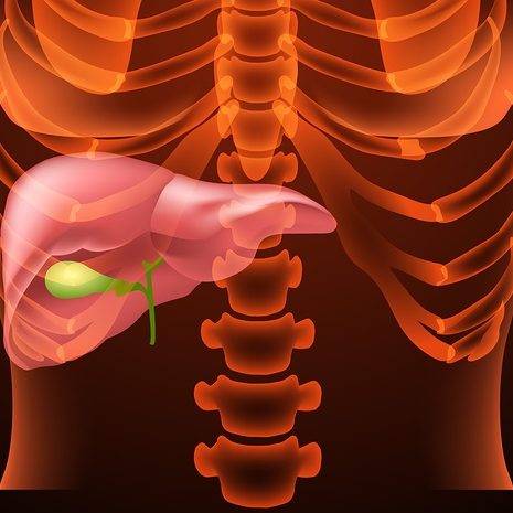 Ρήξη της χοληδόχου κύστης