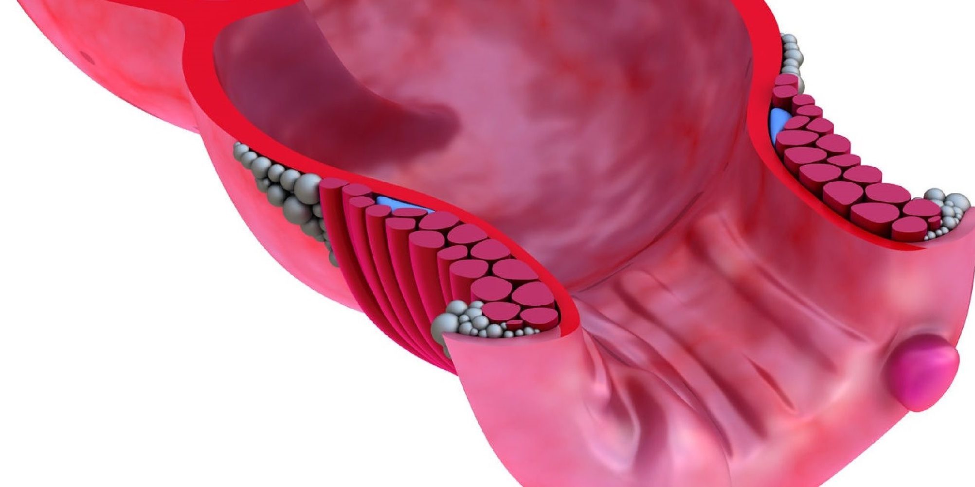 Ραγάδες πρωκτού, αίτια, συμπτώματα, αντιμετώπιση